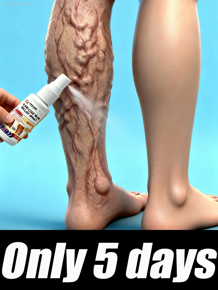 It's Your Best Choice to Say Goodbye to Pain and Discomfort, Restore Your Legs' Natural Luster, and Is Suitable for Everyone.