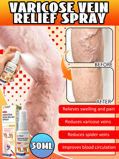 It's Your Best Choice to Say Goodbye to Pain and Discomfort, Restore Your Legs' Natural Luster, and Is Suitable for Everyone.