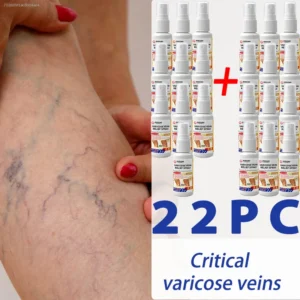 It's Your Best Choice to Say Goodbye to Pain and Discomfort, Restore Your Legs' Natural Luster, and Is Suitable for Everyone.